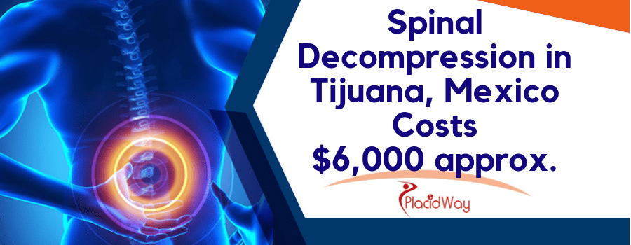 Spinal Decompression in Tijuana, Mexico